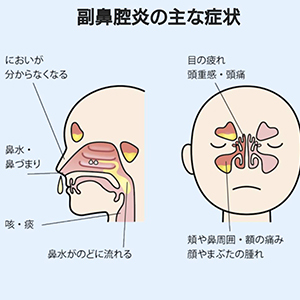 私の闘病④ 勘違いするとこでした|酵素浴・よもぎ蒸し・笹蒸し｜安城市｜カフェ＆サロンおさかなの手紙