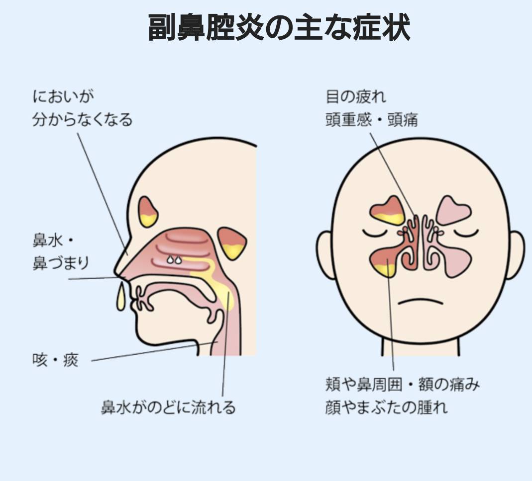 酵素浴・よもぎ蒸し・笹蒸し｜安城市｜カフェ＆サロンおさかなの手紙